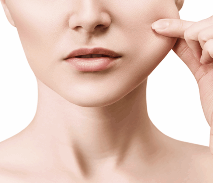 Buccal fat removal