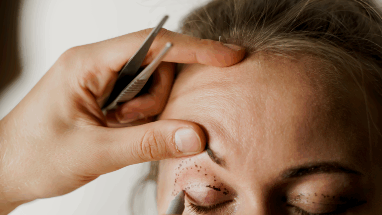 Blepharoplastie ophtalmologique Blépharoplastie ophtalmologique