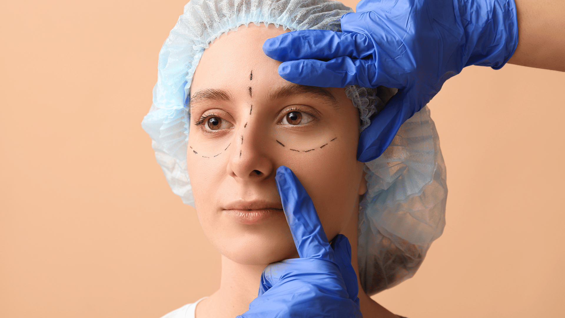 Blépharoplastie