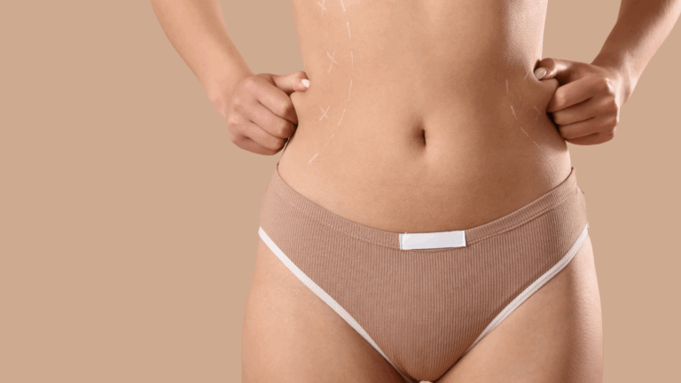 Bodylift Bodylift