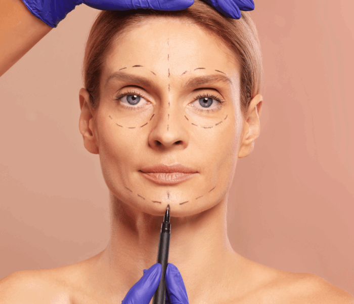 Genioplasty